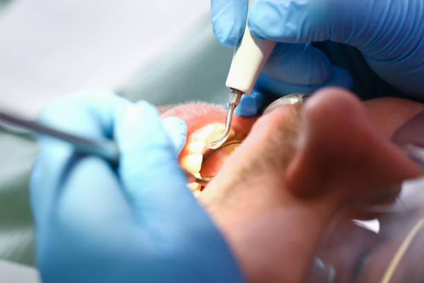 Best Mobile Emergency Dentist in Houghton, MI