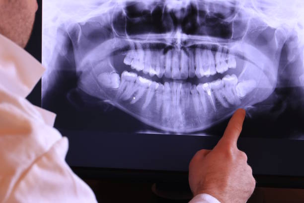 Best Emergency Dentist for Lost Fillings or Crowns in Houghton, MI